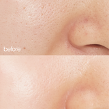 biome boost cream daily moisturizer before and after pictures. Pores have  been visibly reduced and redness gone.