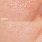 skin before and after and using biome boost cream collagen moisturizer