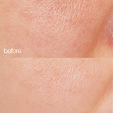 skin before and after and using biome boost cream collagen moisturizer