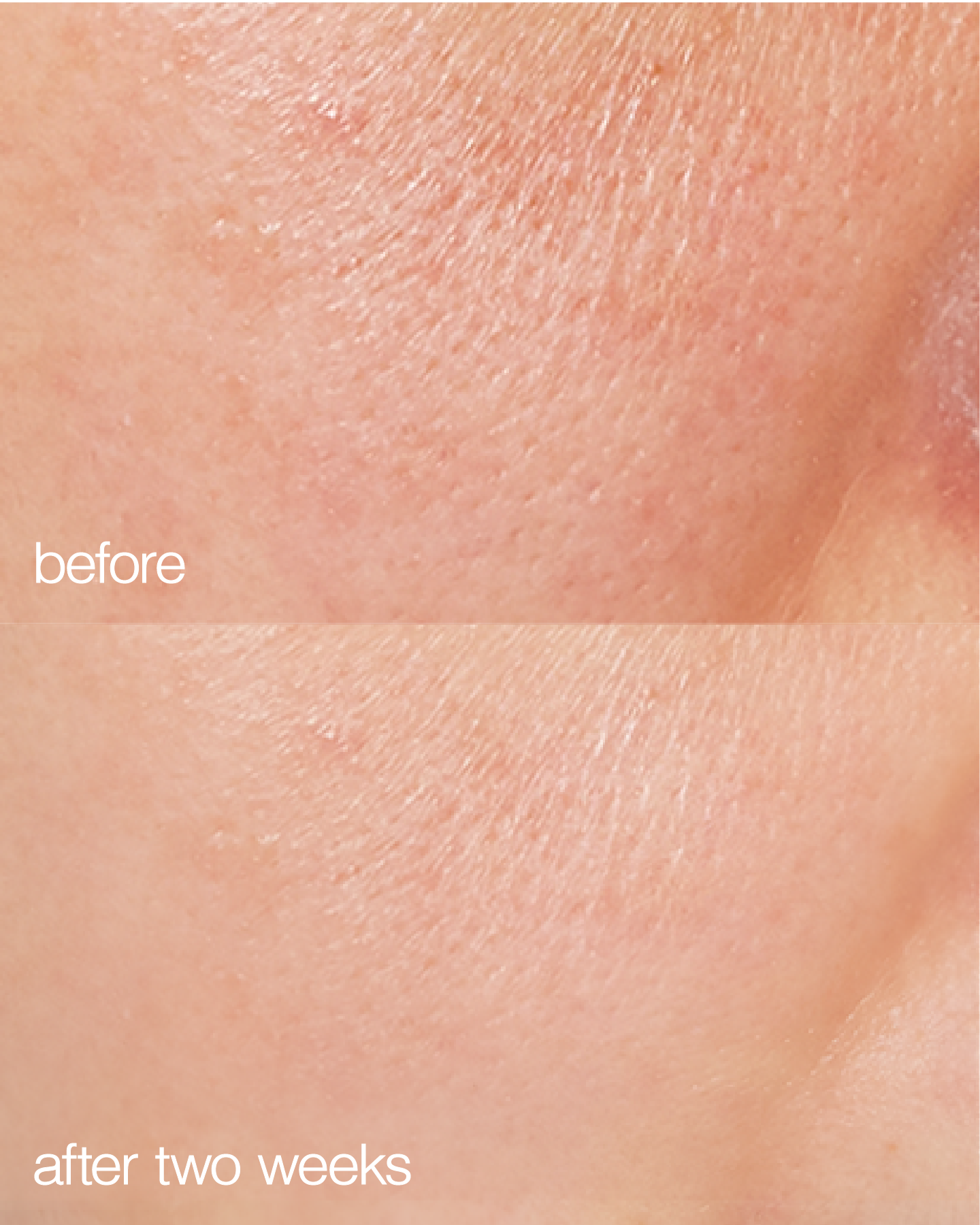 skin before and after and using biome boost cream collagen moisturizer