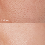 before + after skin use of LAPCOS collagen moisturizer