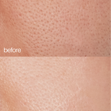 before + after skin use of LAPCOS collagen moisturizer