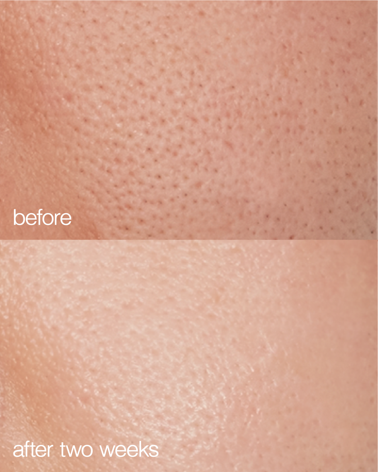 before + after skin use of LAPCOS collagen moisturizer