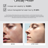clinical results of biome boost cream daily moisturizer. Image shows before of inflamed and red skin and after using the cream skin is even and bright.
