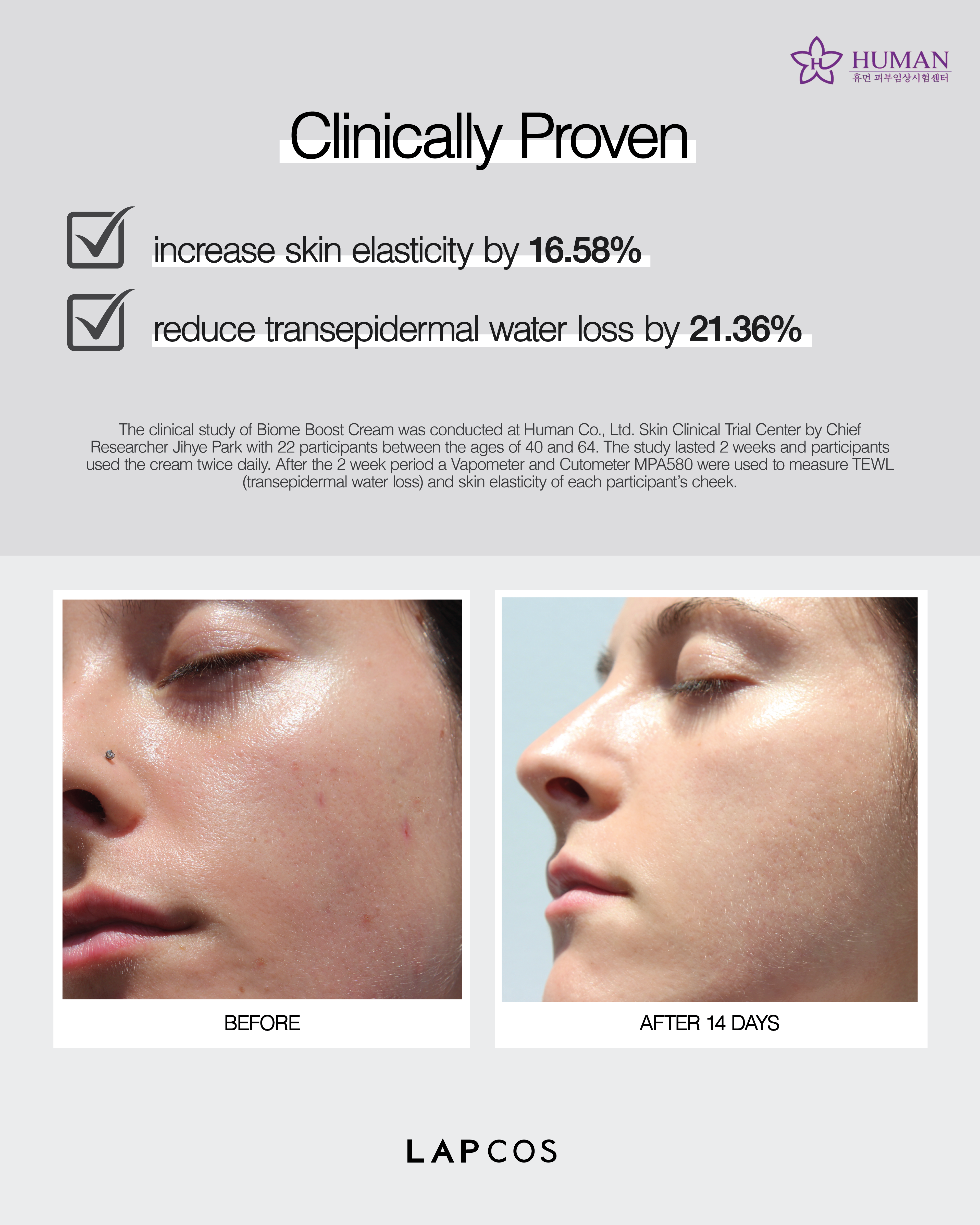 clinical results of biome boost cream daily moisturizer. Image shows before of inflamed and red skin and after using the cream skin is even and bright.